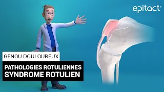 Syndrome Rotulien  Explication  EPITACT [upl. by Raknahs]