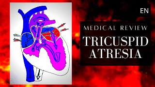 Esophageal Atresia Explained  Cincinnati Childrens [upl. by Nagap614]