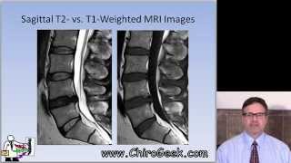 Dr Gillard lectures on How to Read Your Lumbar MRI [upl. by Aurie]