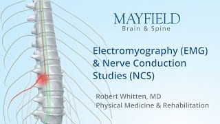 EMG Electromyography in Biomechanics  Delsys [upl. by Rollecnahc]