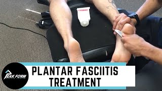 Plantar Fasciitis Treatment San Diego Graston Chiropractic [upl. by Ymmat957]