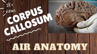 Corpus callosum  Air Anatomy [upl. by Huber598]