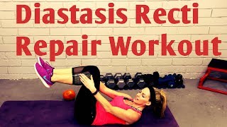 15 Minute Diastasis Recti Repair WorkoutPostnatal Core After Pregnancy [upl. by Lehcar]