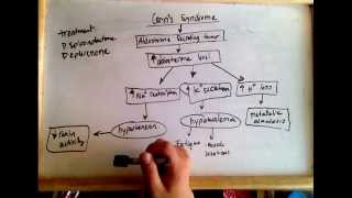 Conns syndrome hyperaldosteronism  cause and treatment [upl. by Alleacim]