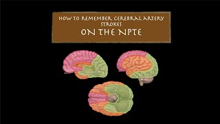 How to Remember Three Cerebral Artery Strokes on the NPTE [upl. by Eekaz]