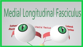 Medial Longitudinal Fasciculus Made Ridiculously Simple [upl. by Merow]