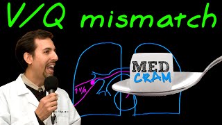 Ventilation Perfusion VQ Mismatch Explained Clearly [upl. by Aynotal837]