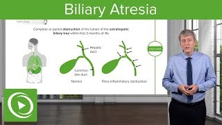 Biliary Atresia – Pediatrics  Lecturio [upl. by Sacrod]