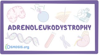 Adrenoleukodystrophy  causes symptoms diagnosis treatment pathology [upl. by Frederica649]