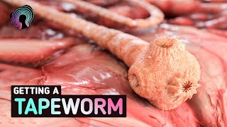 What Happens When You Get Tapeworms Warning distressing footage [upl. by Angell125]