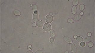 Bakers Yeast under the Microscope [upl. by Healy]