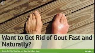 How to Get Rid of Gout Fast and Naturally in Easy Steps [upl. by Quirk]