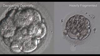 Optimal Embryo Development and Assessment [upl. by Nedrob]