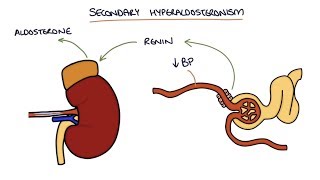 Hyperaldosteronism and Conns Syndrome [upl. by Nonnahsed]