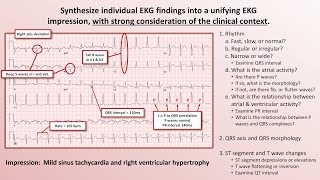 Echocardiography Essentials Mastering the apical fourchamber view 4CV [upl. by Romina978]