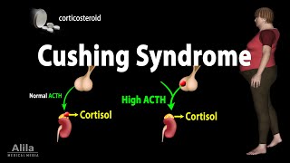 Cushing Syndrome Animation [upl. by Tomkiel668]