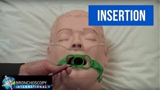 Preparing for Bedside Bronchoscopy [upl. by Ailecra301]